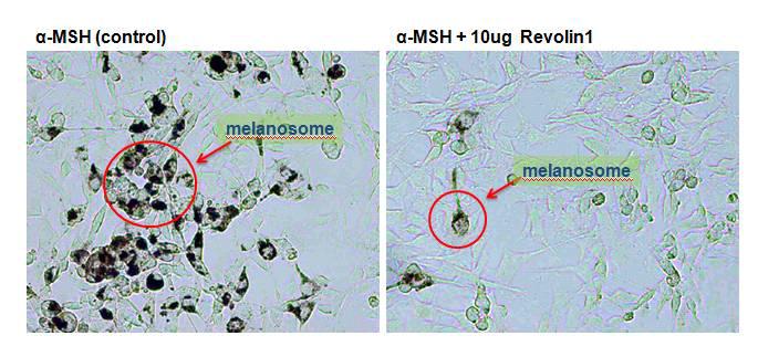 Revolin1 에 의한 melanocyte morphology 관찰 및 melanin 합성 양 억제