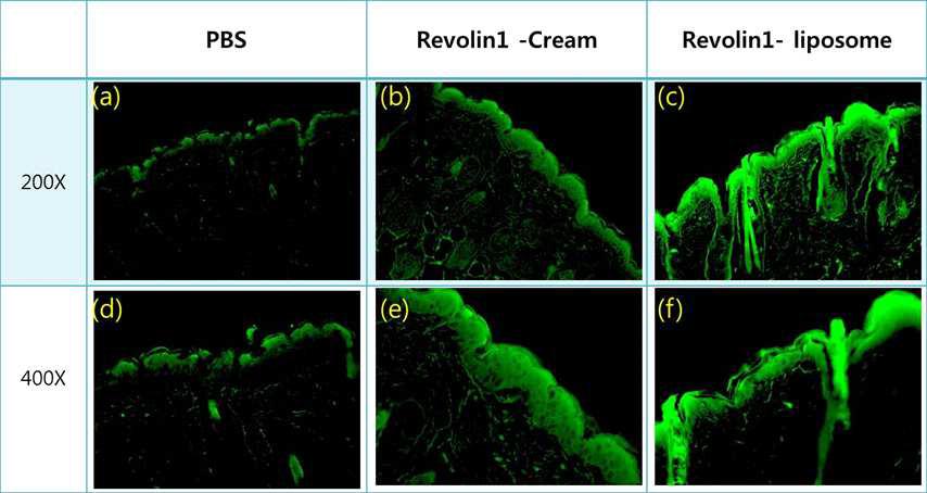 Revolin-1의 detection을 위한 immunohistochemistry 결과