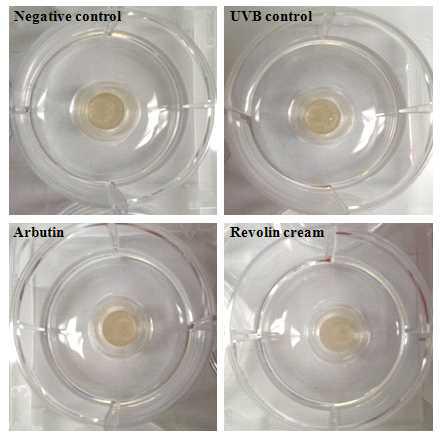 Melanoderm skin model 에 UVB 조사 후 Revolin1 cream에 대한 효능 관찰