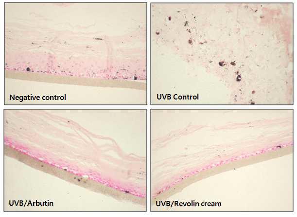 Higtology 분석을 통해 피부조직에서의 Revolin1 cream 에 의한 melanosome 관찰