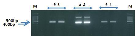 PCR product 의 A-tailing 결과