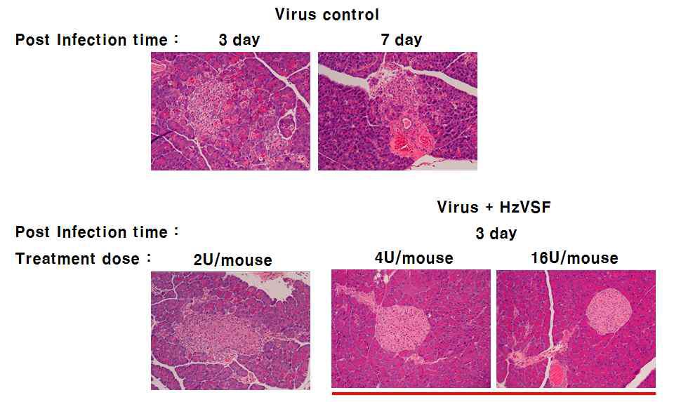 바이러스성 당뇨병에서 HzVSF w의 염증세포 침윤억제