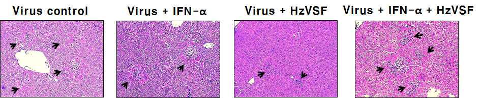 MHV-2cc에 대한 HzVSF w의 급성간염 억제 효과