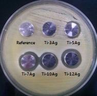 18시간 박테리아 배양 후 Petri dish image.