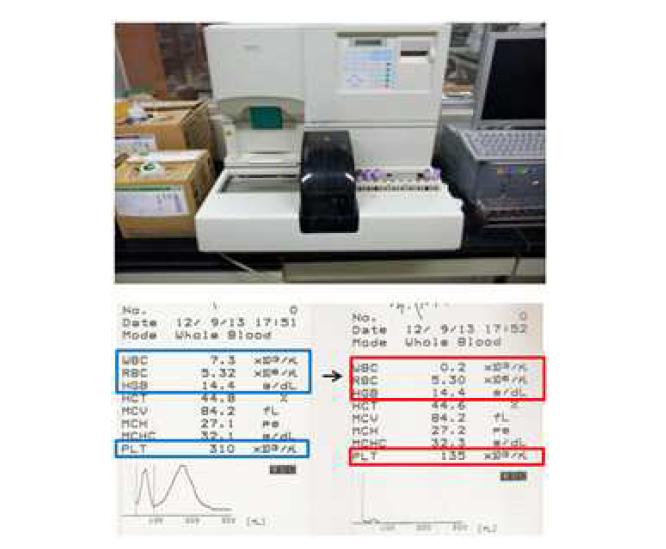 혈액 구성성분 분석 기기와 혈액구성 성분표.