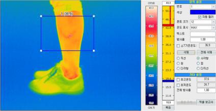 열화상카메라 데이터 분석 프로그램 ThermoNote 측면 측정