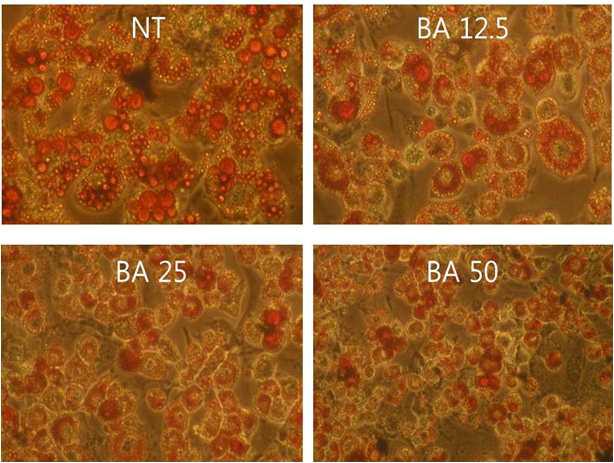 지방세포에서 BA 농도별 지방구 크기 변화
