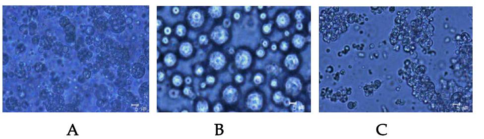 Microphotographs of W/O/W double emulsion for peanut sprout extracts Core material: Extract of peanut sprout 1mg/mL