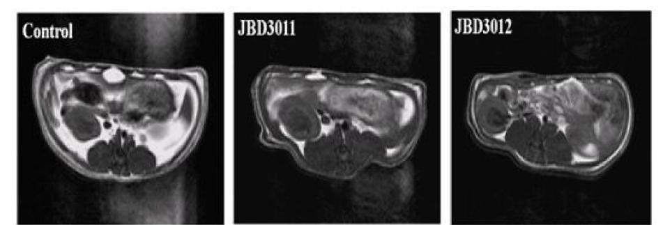 JBD301의 내장지방 감소 효과 MRI