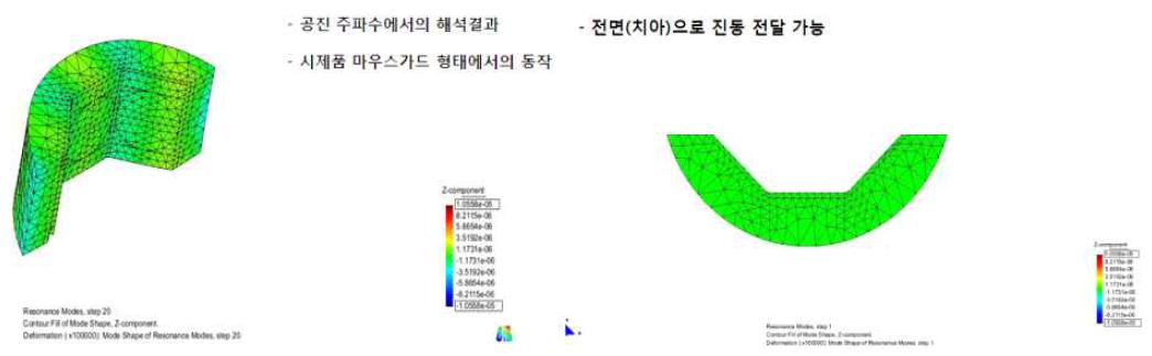 고속 치아 미백기의 전체구조의 음장 해석