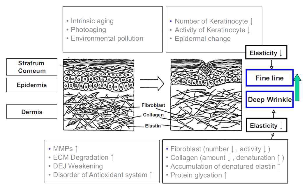 피부 노화