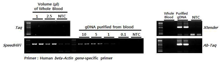 Direct PCR을 위한 최적 PCR 효소 선별. Human whole blood 시료와 human beta-actin gene -specific primer를 이용하여 테스트.