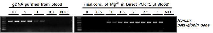 Direct PCR을 위한 최적 PCR 반응 조건 set-up. Reaction buffer의 Mg2+ 농도에 따른 Direct PCR 효율을 1 μl의 사람 전혈을 사용하여 테스트.