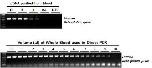 혈액 시료로부터 Direct PCR 테스트. 혈액 시료의 양에 따른 Direct PCR의 증폭 효율을 비교하기 위하여 혈액으로부터 분리/정제된 gDNA를 대조군으로 비교 테스트함.
