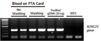 혈액 시료가 흡착된 FTA Card (Whatman, USA)로부터 Direct PCR 테스트. 혈액이 흡착된 FTA card로부터 0.5 mm 크기의 membrane 조각을 punch하여 washing 여부에 따른 Direct PCR 테스트.