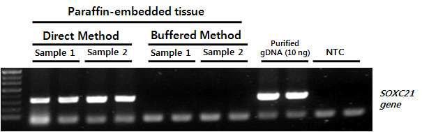 Paraffin-embedded tissue로부터 Direct PCR 테스트.