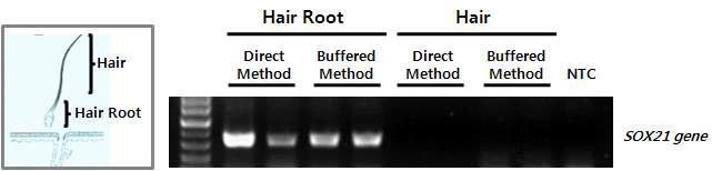 머리카락 시료에서 Direct PCR 테스트. Target DNA의 증폭은 모근 부분(Hair root)에서만 확인 됨.