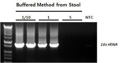 분변 시료로부터 Direct PCR 테스트. 분변 시료는 Buffered Method에서만 Target DNA를 증폭하였으며, 특히 다른 시료들과는 다르게 많은 양의 Dilution Buffer를 사용하면서 상대적으로 더 적은 양의 Lysate를 사용할 경우, 더 효율적인 Direct PCR 증폭 결과를 얻을 수 있음이 확인됨.