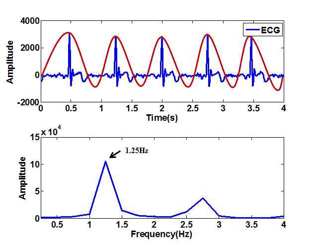 시간영역 ECG신호와 주파수영역(0~4Hz) ECG