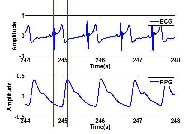 심전도 신호(상)과 PPG 신호(하)