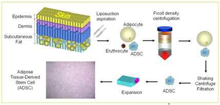 성체지방줄기세포(ADSC) 분리 공정 예