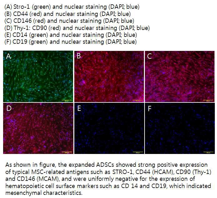 추출, 분리된 ADSC의 줄기세포 특이적 유전자 발현 및 줄기세포 표면 단백질의 발현 평가