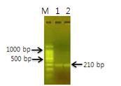 SP-IGF와 IGF-SP의 62℃ PCR 산물
