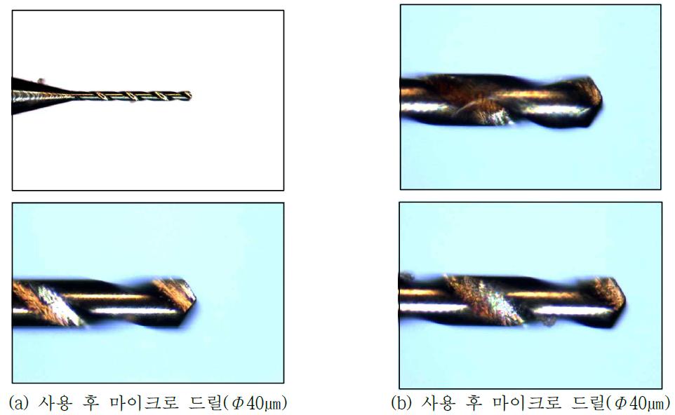 마이크로 드릴 사용 전 후 비교(B사)