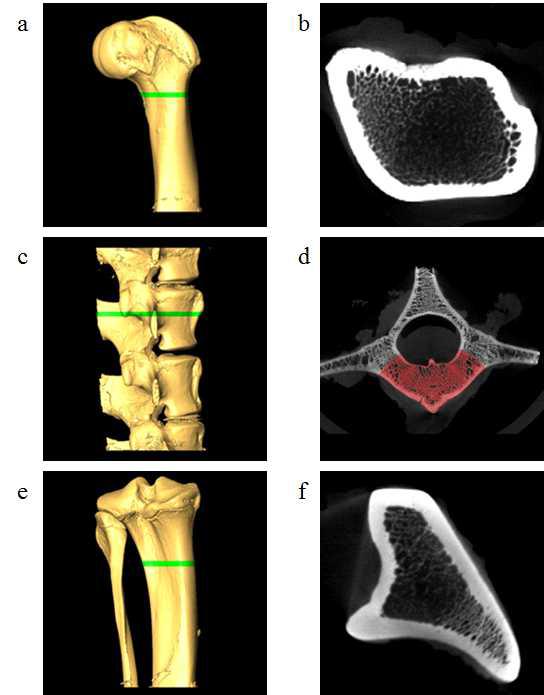 대퇴골(a, b), 요추(c, d), 경골(e, f)의 ROI선정 모식도