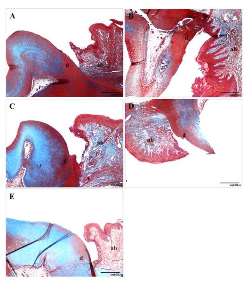 Masson's trichrome stain 염색법에 따른 조직학적 소견