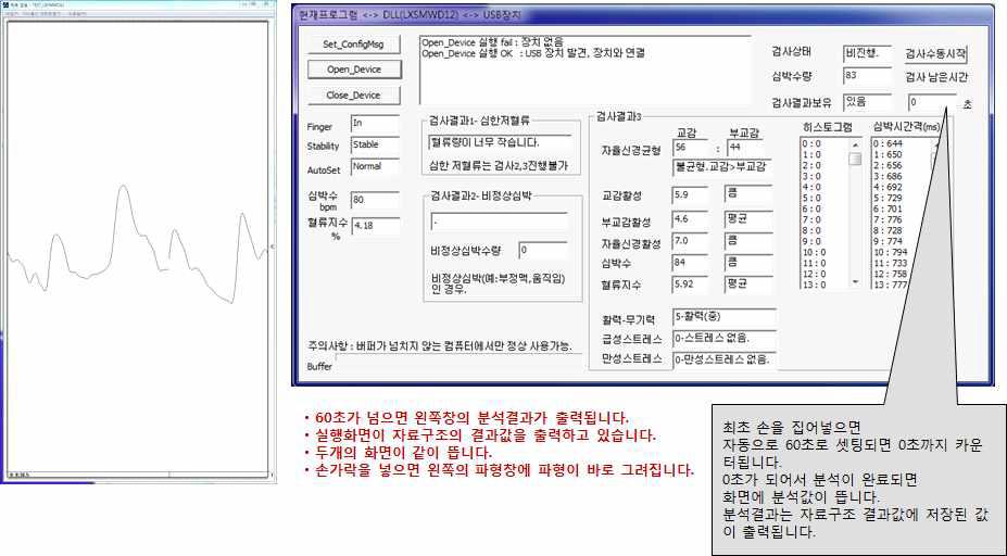 스트레스 분석 측정 Prototype 어플리케이션