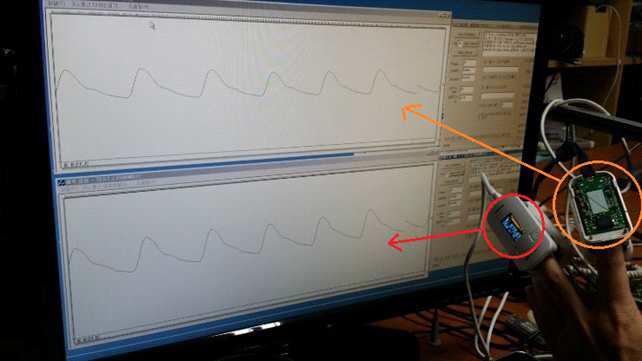 맥파 측정 정확도 확인을 위한 동시 측정