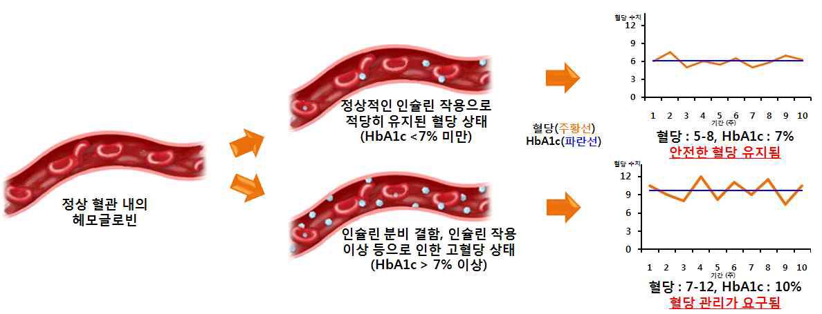 당뇨병 지표인자 당화혈색소 (HbA1c)를 이용한 혈당 관리