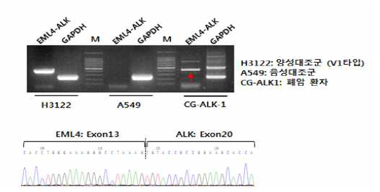 폐암 환자 CTC에서 ALK 변이 검출