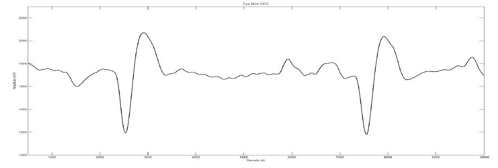 Eye Blink EEG Signal