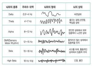 뇌파의 종류별 형태 및 뇌의 활동 상태