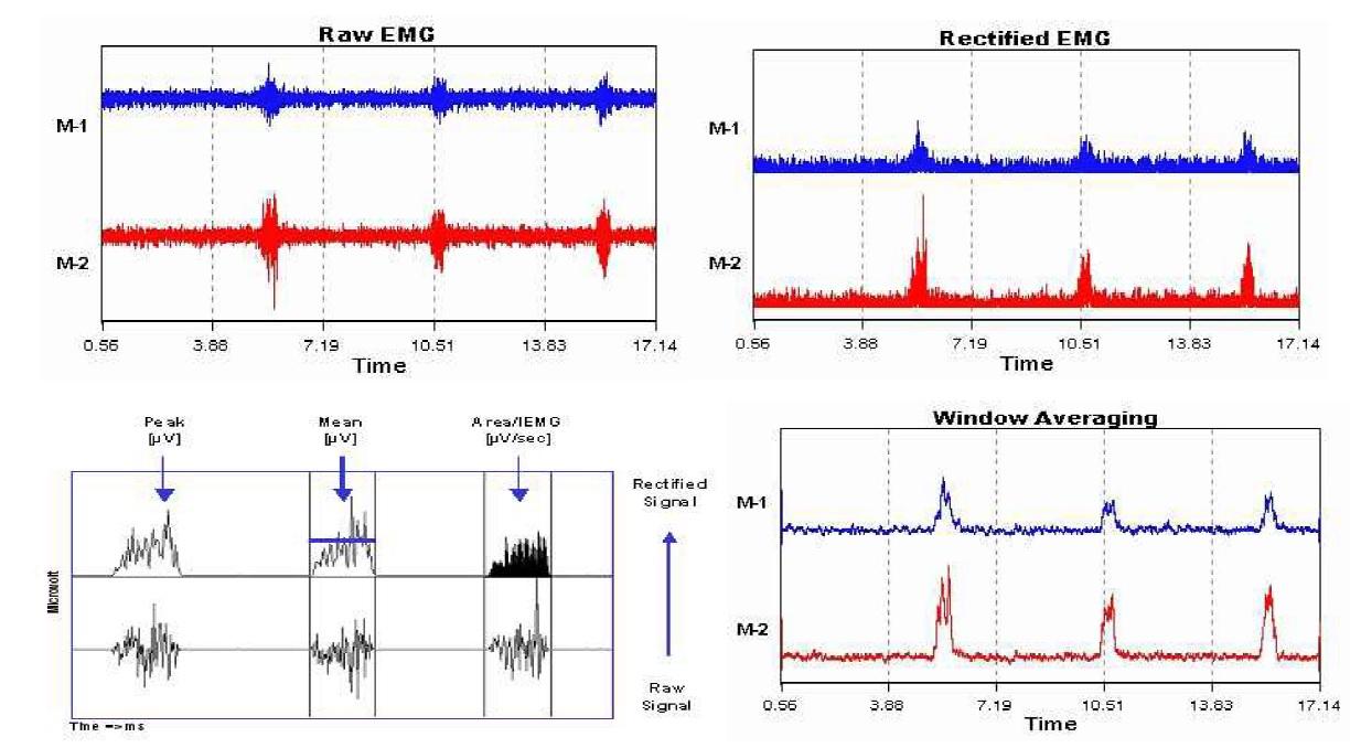 운동 시 측정된 실시간 Raw EMG 분석과정