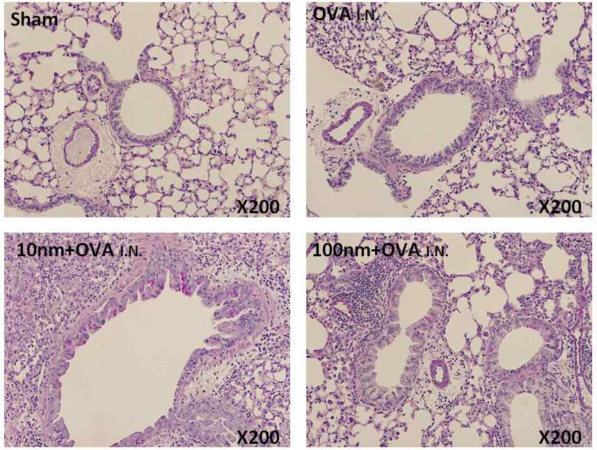 은나노입자 크기에 따른 폐 조직학적 소견