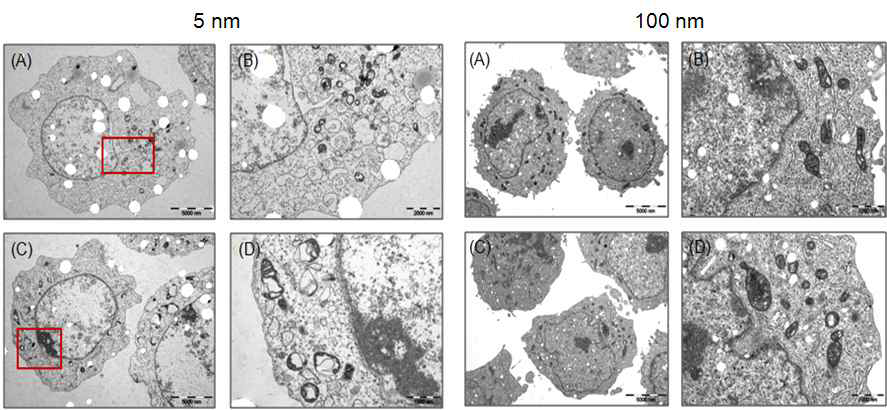 은나노입자에 의한 세포 변화를 TEM으로 관찰