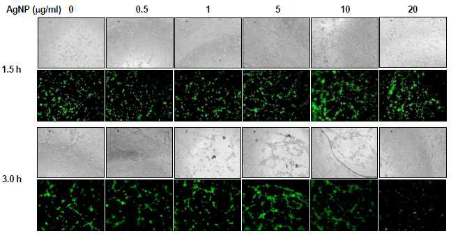 in vitro에서 은나노입자에 의한 내피세포 튜브 형성 능력 관찰