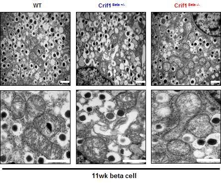 그림 86 CRIF1 결손 마우스의 베타세포 미토콘 드리아 morphology 변화 관찰