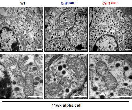 그림 87 CRIF1 결손 마우스의 alpha cell 미토콘 드리아 morphology 변화 관찰