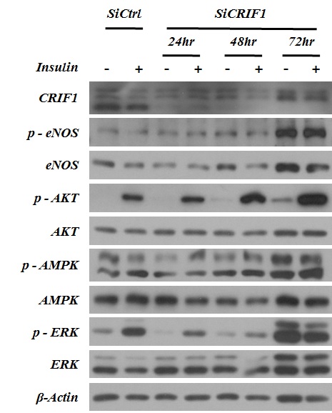 그림 108 MS1 세포주에서 CRIF1 유전자 소실 시간에 따른 인슐린 신호 전달 확인