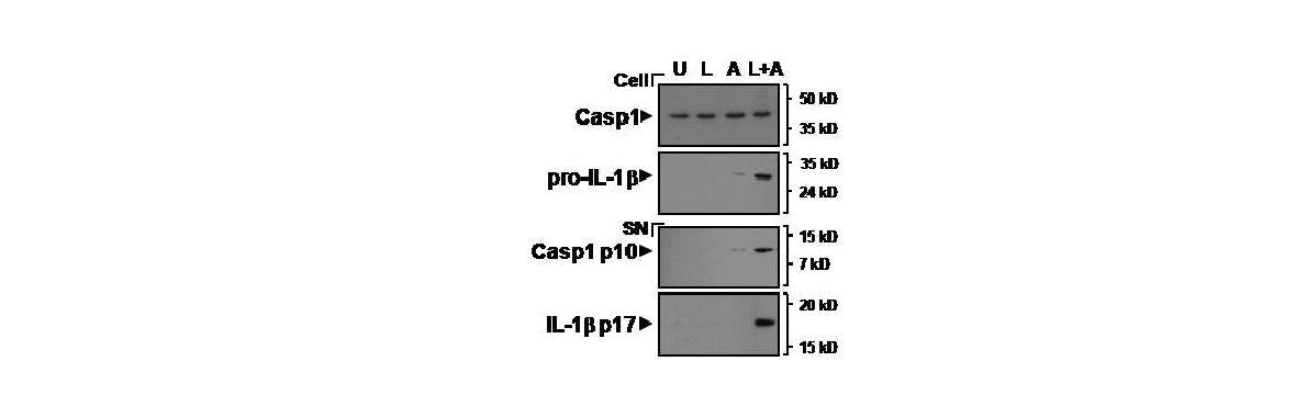 그림33 정상인 말초혈액 유래 대식세포에서의 NLRP3 인플라마좀 복합체 관련 발현 단백질 확인 실험기법 확립