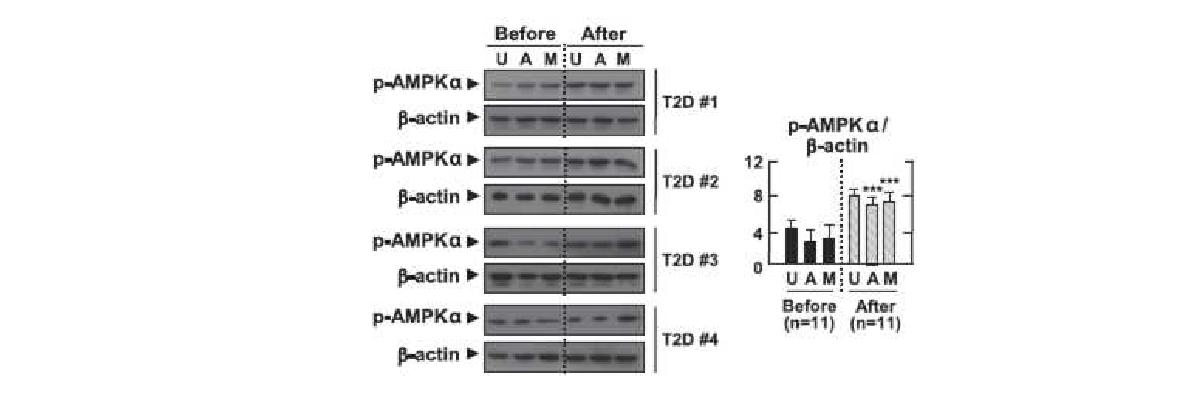 그림38 제2형 당뇨병 환자의 유병기간 내 metformin 치료 전·후 AMPK의 활성도 측정