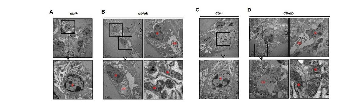 그림 21. EM을 이용한 비만쥐의 갑상선 세포의 소기관 관찰