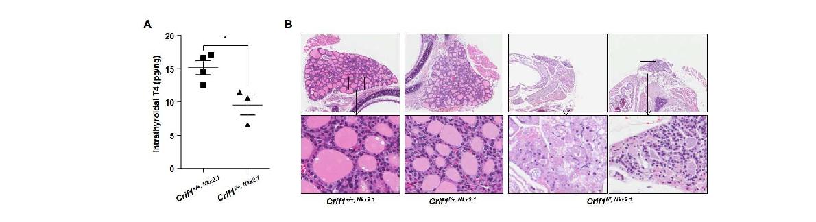 그림 62. 형질전환 마우스 (Nkx2.1-Cre)의 갑상선 호르몬 및 형태적 변화
