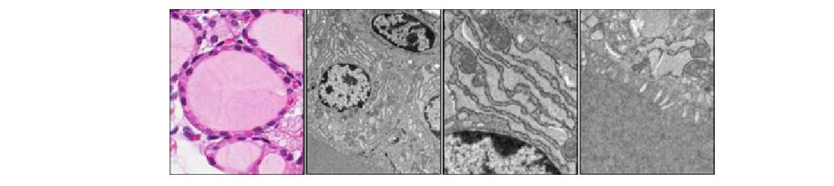 그림 63. Nkx2.1-Cre 마우스(Crif1+/+, Nkx2.1)의 갑상선에서 갑상선 여포와 세포소기관 관찰