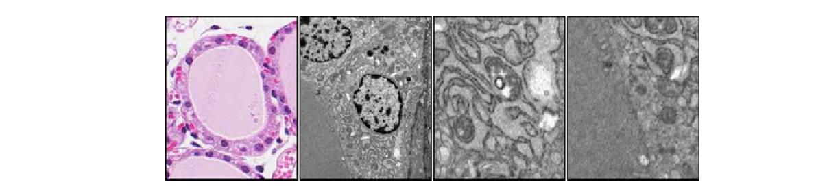 그림 64. 갑상선 특이적 Crif1 부분 결손 마우스(Crif1f/+, Nkx2.1)의 갑상선에서 갑상선 여포 와 세포소기관 관찰