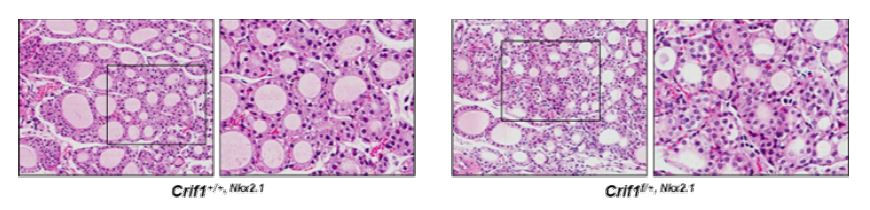 그림 79. 3주간 rhTSH 자극에 의한 갑상선 여포 및 여포세포의 형태학적 변화
